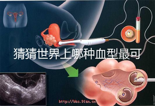 猜猜世界上哪種血型最可怕，史上超全排行榜為你揭曉答案