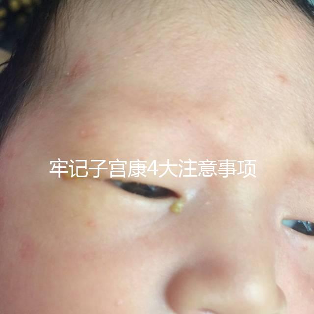 牢記子宮康4大注意事項，輕松避免胃脹、腹瀉等副作用