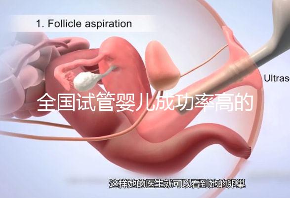 全國試管嬰兒成功率高的醫(yī)院排名，內(nèi)附2023試管費用及成功率參考