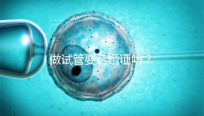 做試管要結(jié)婚證嗎？