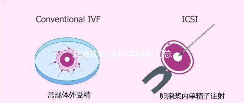 北京市知名助孕機構(gòu)匯總，成功率多少一看便知！