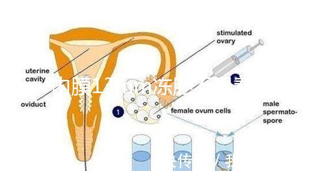內膜13mm凍胚不易著床要注意，移植與否看醫生怎么說