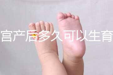 剖宮產后多久可以生育二胎？