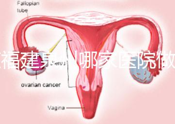 在福建泉州哪家醫(yī)院做試管嬰兒好