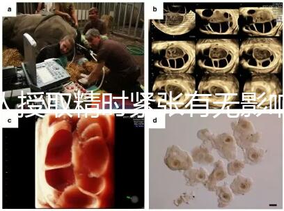 人授取精時(shí)緊張有無影響別還不造，注意事項(xiàng)不少不可不知