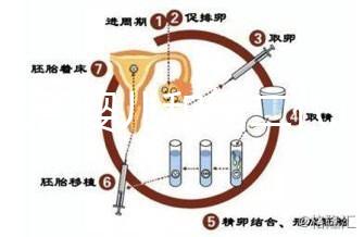代試管嬰兒和第二代試管嬰兒的區別,基因篩查技術!