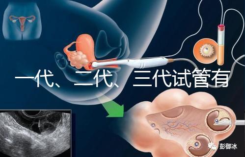 一代、二代、三代試管有什么區(qū)別？