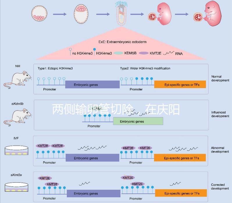 兩側輸卵管切除,在慶陽有醫院能做試管嬰兒嗎?