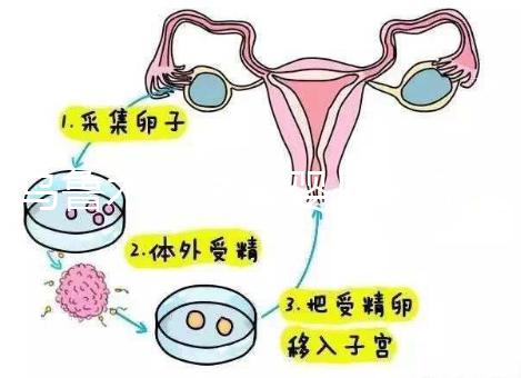 烏魯木齊試管嬰兒醫院排名最好（新疆試管成功率最高的醫院）