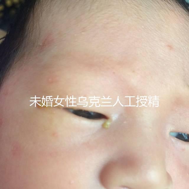 未婚女性烏克蘭人工授精必看！醫療及生活費用明細預覽