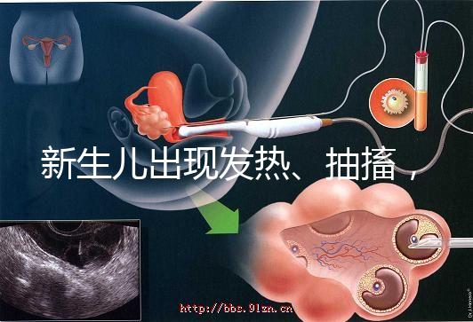 新生兒出現(xiàn)發(fā)熱、抽搐，很可能是胎毒的表現(xiàn)