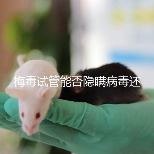 梅毒試管能否隱瞞病毒還沒(méi)有建造,備案記錄已經(jīng)通知