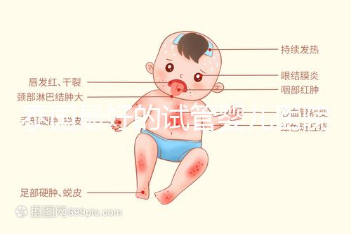 泰國最好的試管嬰兒醫(yī)院(泰國最好的試管嬰兒醫(yī)院是哪個)