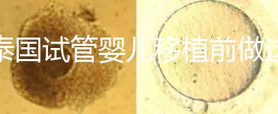 泰國試管嬰兒移植前做這3件事能提高成功率，不然會后悔！