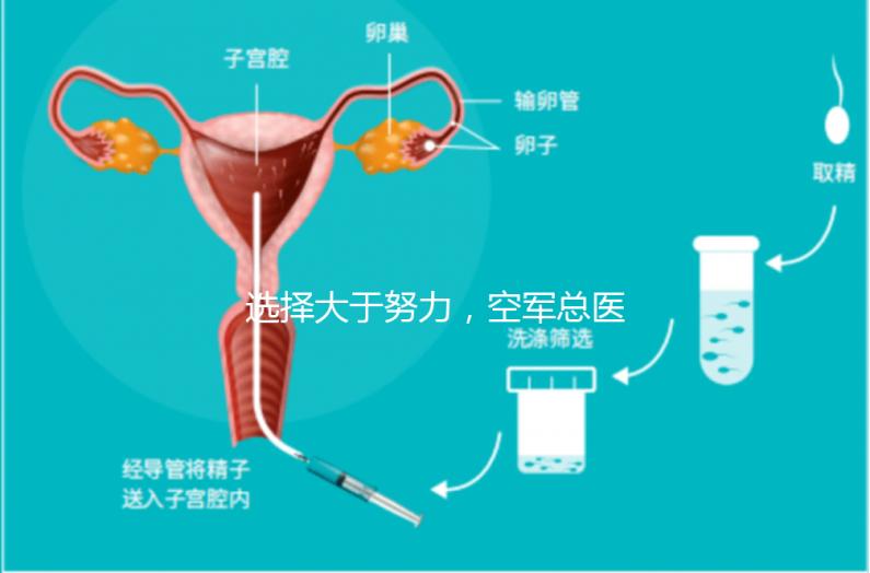 選擇大于努力,空軍總醫院做試管嬰兒必讀攻略