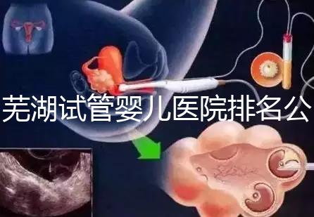 蕪湖試管嬰兒醫(yī)院排名公開，弋磯山醫(yī)院、蕪湖二院獲好評