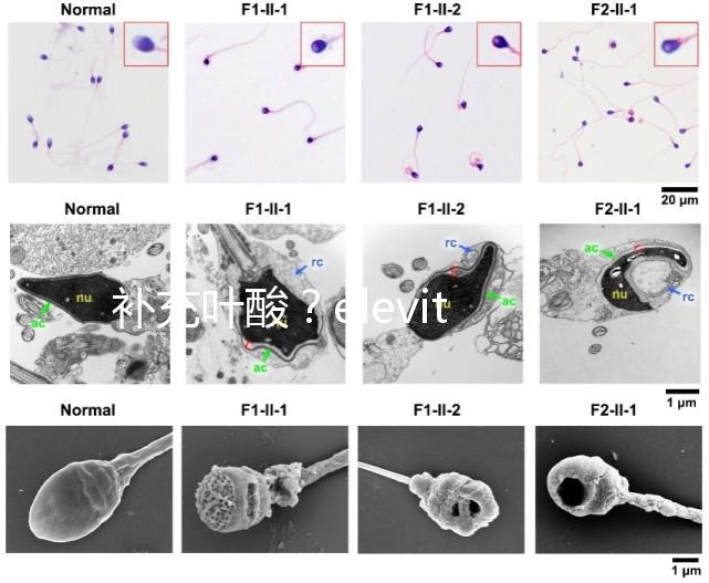 補充葉酸?elevit愛樂維那你不得不了解