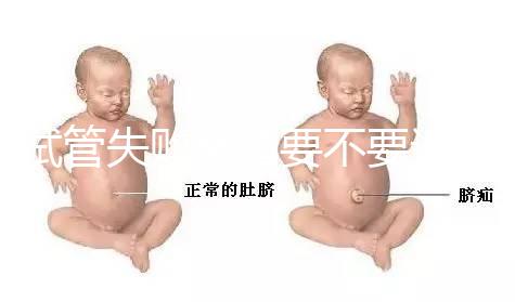 試管失敗離婚要不要退彩禮揭秘，三金怎么處理？