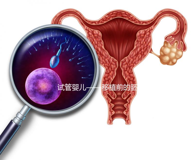 試管嬰兒——移植前的胚胎選擇！