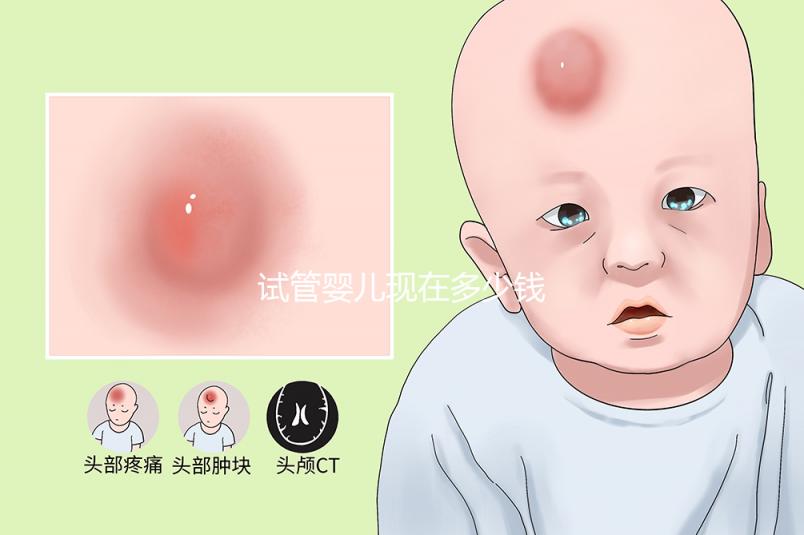 試管嬰兒現在多少錢