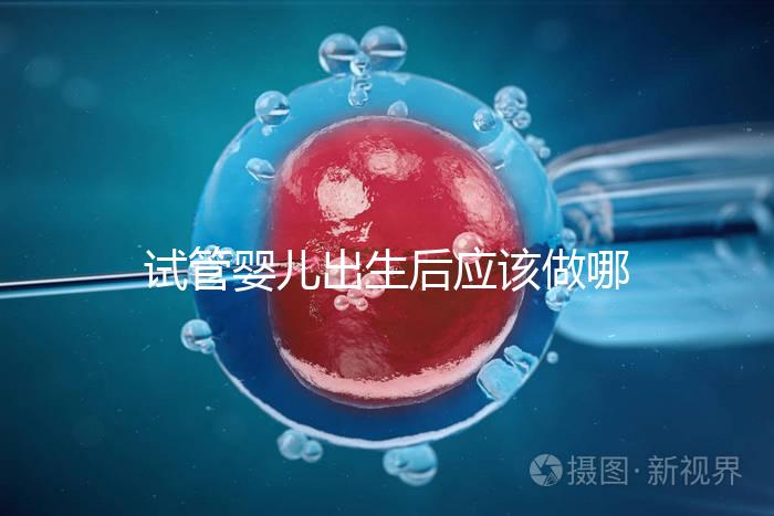 試管嬰兒出生后應該做哪些檢查答案？DR應該看情況嗎？