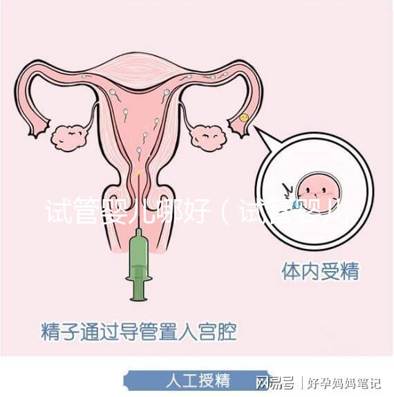 試管嬰兒哪好(試管嬰兒權(quán)威醫(yī)院哪家最好)