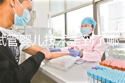 試管嬰兒技術走到了哪一步?專家解答→