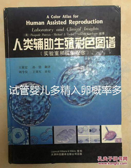 試管嬰兒多精入卵概率多少難說(shuō),比正常配對(duì)低別瞎操心