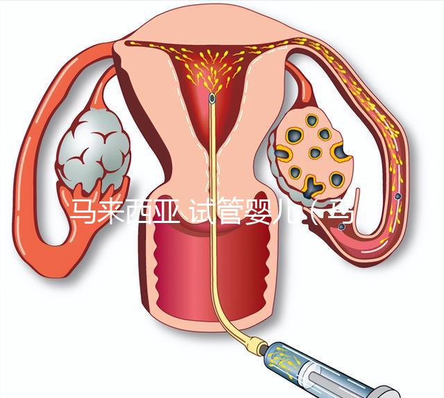 馬來西亞 試管嬰兒(馬來西亞試管嬰兒和泰國(guó)比較哪個(gè)更好)