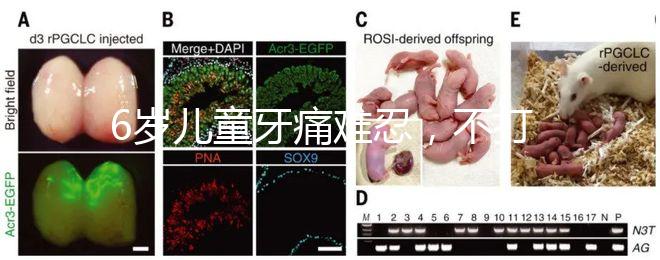 6歲兒童牙痛難忍,不打針吃藥5個小妙招快速止疼