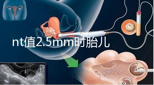 nt值2.5mm時胎兒異常幾率并不高,但羊水穿刺一定要做